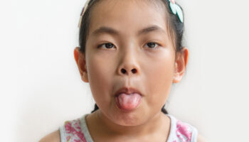 Tongue-Tie: Why It Matters!